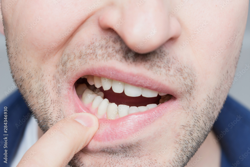 Man showing his teeth, close up Man showing his teeth, close up
