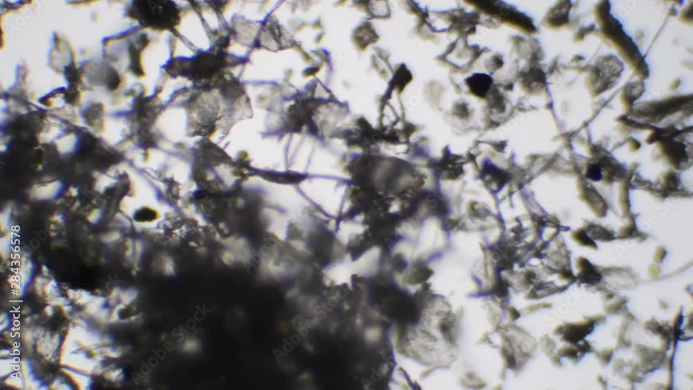 顕微鏡で見たハウスダストに潜むダニ