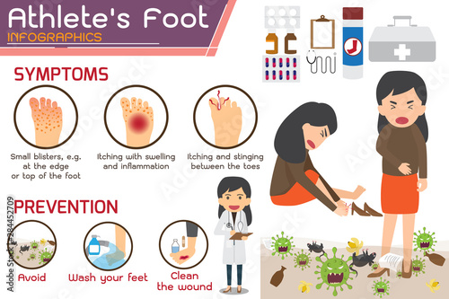 Athlete’s foot or Hong kong foot Disease Infographics. wounds on foot. symptoms and prevention Athlete's foot. health and medicine cartoon vector illustration.