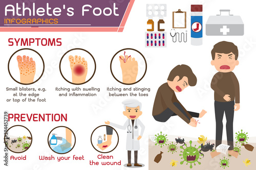 Athlete’s foot or Hong kong foot Disease Infographics. wounds on foot. symptoms and prevention Athlete's foot. health and medicine cartoon vector illustration.