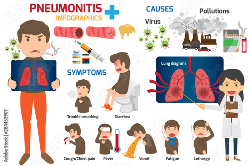 Infographics, content for healthcare in the concepts and symptoms of lung cancer, risk factors, prevention / treatment of vector diseases, pneumonia health and medical vector illustration.