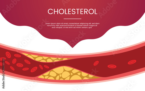 cholesterol human vein concept theme for template banner or landing homepage infographics - vector
