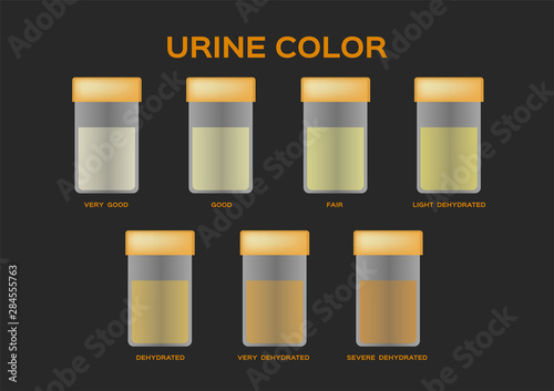 urine color vector / transparent yellow orange