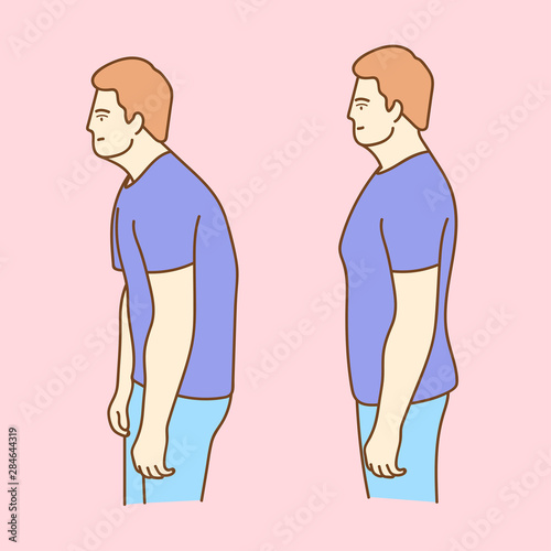 Impaired posture position defect scoliosis and ideal bearing.