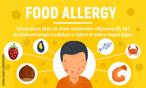Food allergy concept banner. Flat illustration of food allergy vector concept banner for web design