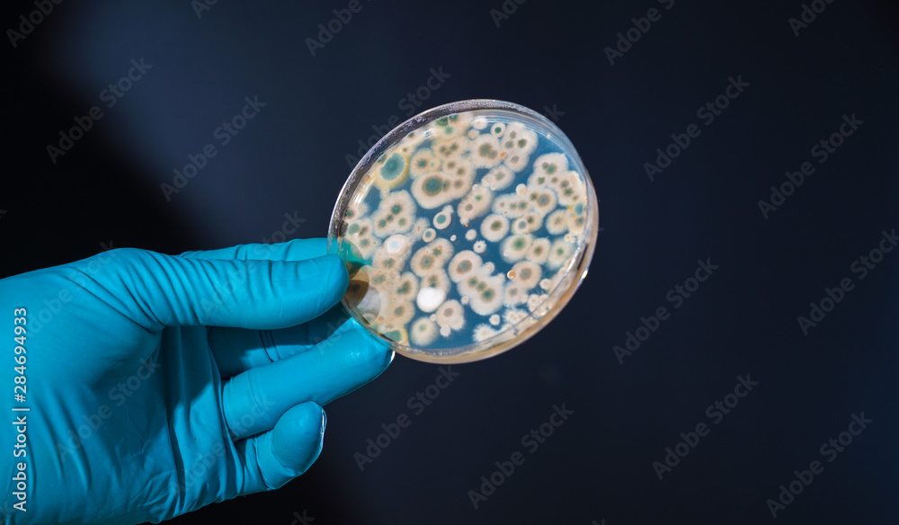 petri dish with microbe colony in doctor hand - obrazy, fototapety, plakaty 