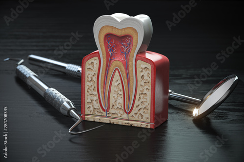 Tooth model cross section with dental tools on black wooden table. Close up. Dental treatmant and hygiene concept. photo