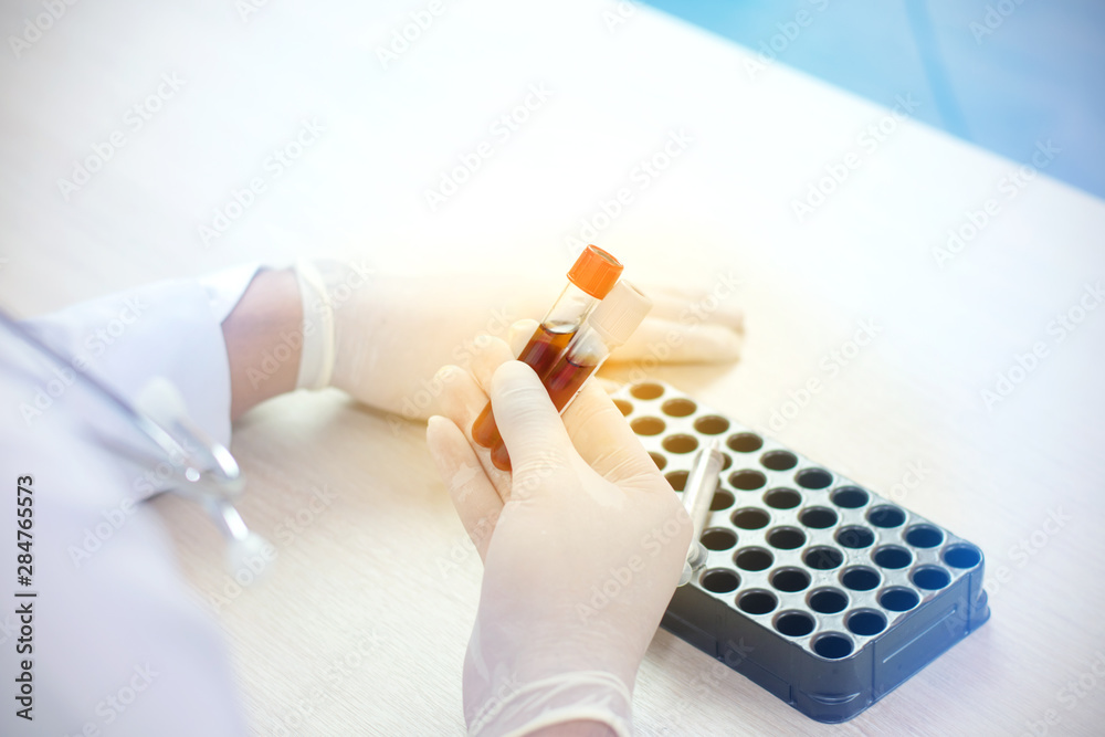 Doctor or Scientist holding tube with blood sample making and test or research in clinical laboratory. Doctor or Scientist holding tube with blood sample making and test or research in clinical laboratory.