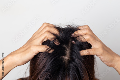 Women itching scalp damaged hair, Haircare concept.