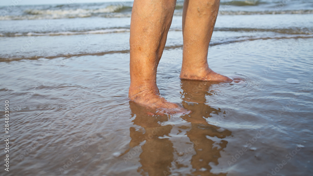 Senior woman's feet are standing on sandy beach, Varicose veins on leg and feet, Asian Body skin part, Healthcare concept Senior woman's feet are standing on sandy beach, Varicose veins on leg and feet, Asian Body skin part, Healthcare concept
