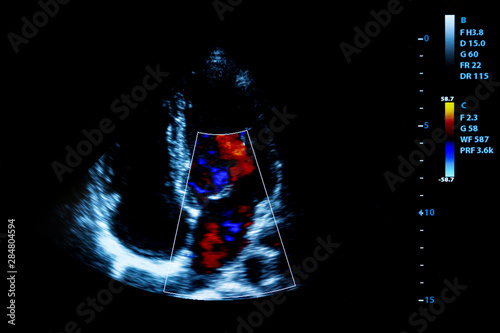 Colourful image of homan heart ultrasound monitor photo