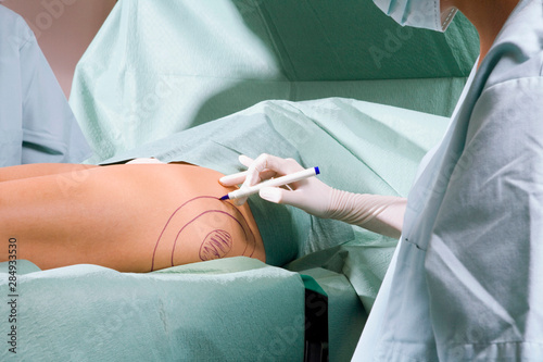 Female surgeon at work