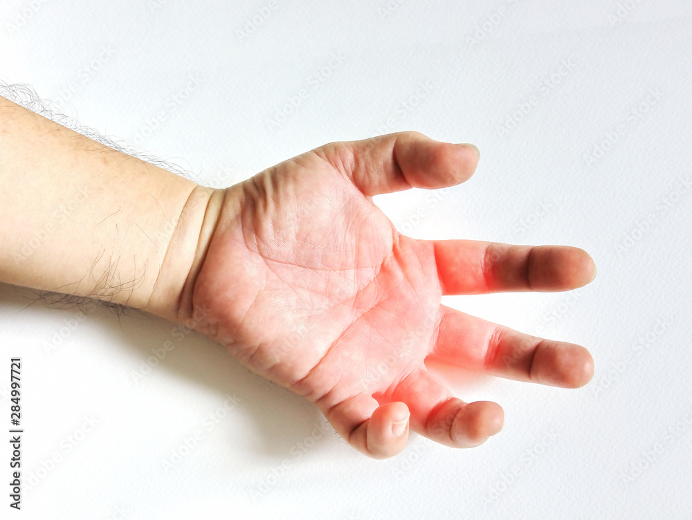 hand and fingers tendinitis ,office syndrome .danger of worker is working in same position for long time. hand and fingers tendinitis ,office syndrome .danger of worker is working in same position for long time.