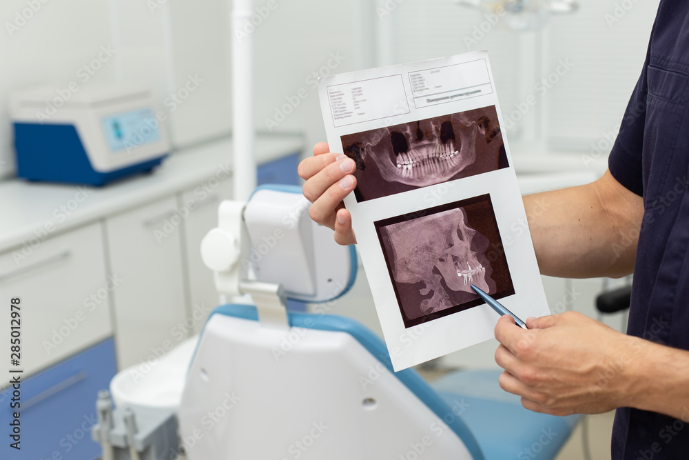 Obraz premium Dental polymerization lamp with UV light and laser. Stomatological instrument in the dentist clinic. Medicine, health, stomatology concept.