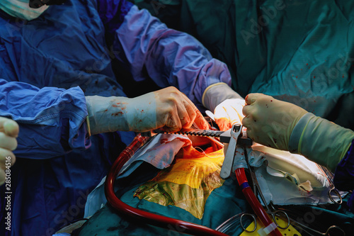 Suture of an lung emphysema surgery in an infant, medical assistance close-up