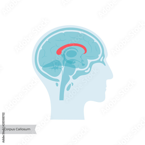 Vector illustration of Corpus callosum