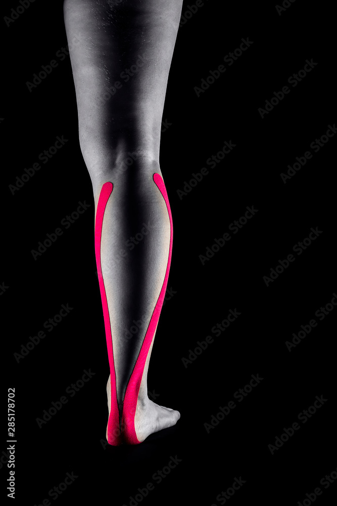 Medical taping for calf pain relief showed on young model. Medical taping for calf pain relief showed on young model.