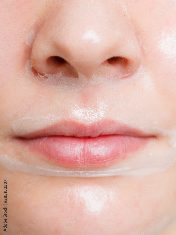 Fototapeta premium Close up woman in facial peel off mask.