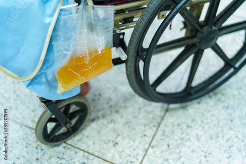 Asian middle-aged lady woman patient sitting on wheelchair with urine bag in the hospital ward : healthy medical concept              photo