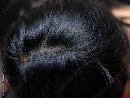 Фотография Young woman shows her white hair roots