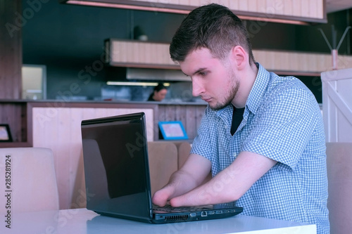 Computer online job. Disabled man freelancer with amputated two stump hands in cafe typing works on laptop Problem of adaptation to life people disabilities. Independent handicapped invalid young guy.