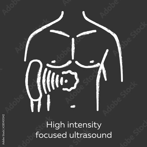 High intensity focused ultrasound chalk icon. HIFU. Non-invasive therapeutic technique. Treatment by ultrasonic waves. Destroying tissue by intense heat. Isolated vector chalkboard illustration