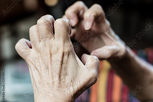 Canvas-taulu Epileptic seizure in hand with cerebrovascular disease in the older age group or dementia