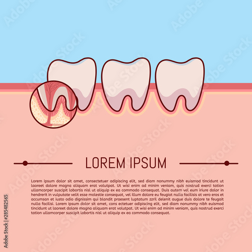 Layout cross-section structure inside tooth illustration vector on blue background. Dental concept.