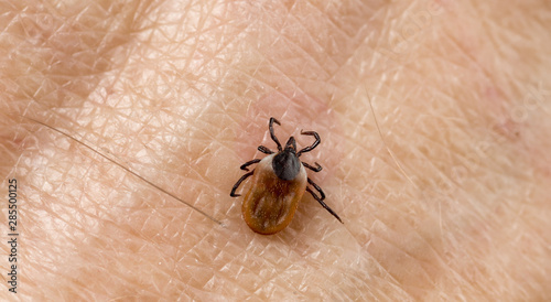Canvastavla A predatory (parasitic) tick crawls along the human skin
