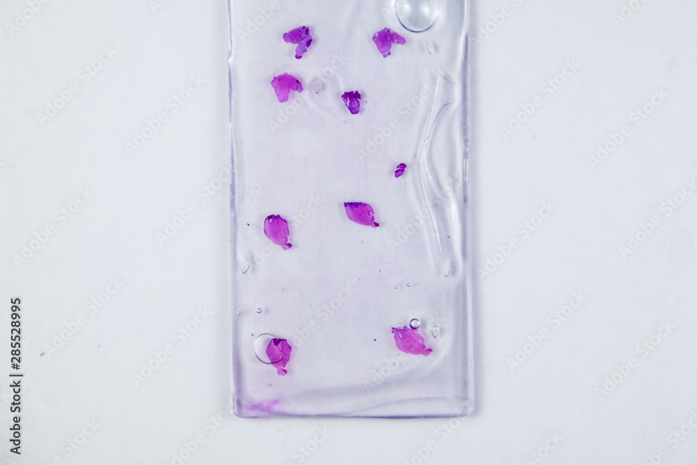 Slices of the tumor under glass. Histological examination of tumor cells for the presence of cancer Slices of the tumor under glass. Histological examination of tumor cells for the presence of cancer