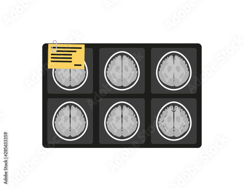 MRI x-ray brain picture in flat style