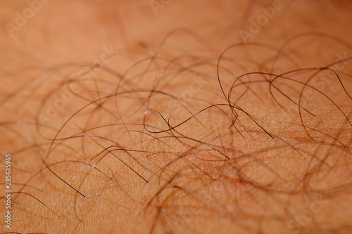 closeup black hair on skin of shin