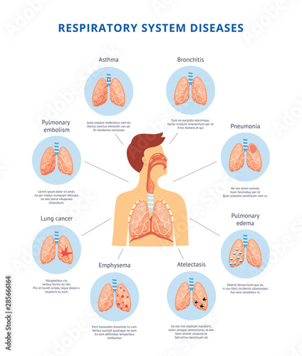 Human respiratory system diseases informative diagram vector illustration. photo