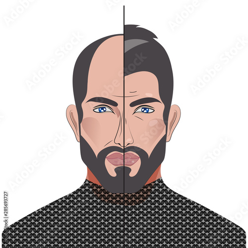 Baldness in man, male with bald head