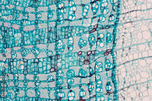 Cross section - Phloem is a type of tissue in vascular plants that transports water and some nutrients.