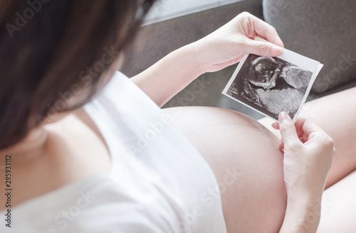 Pregnant women holding a sonogram
