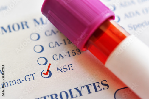 Blood sample tube for Neuron-Specific Enolase or NSE test, tumor marker for lung cancer photo