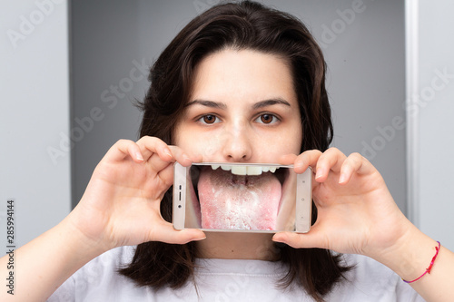 Girl showing the magnified image of her tongue with Candida albicans through a smart phone