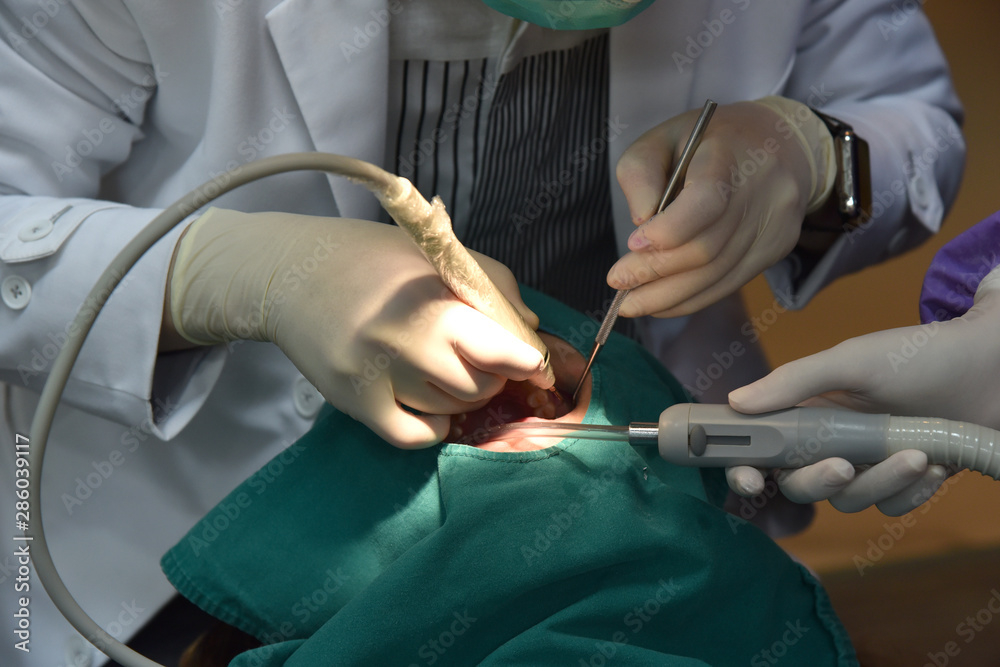 Dental care check up, Dentist examining and doing teeth treatment in dental clinic, Yearly visit for teeth cleaning and scaling to prevent gum disease problems, Healthy oral hygienic.