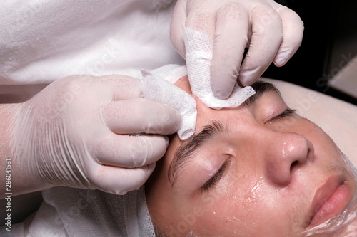 A beautician in white gloves squeezes acne on the boy's forehead. Dermatological teenage skin cleansing procedure. Men's hygiene and personal care. Teen guy at the cosmetology center. Close-up.