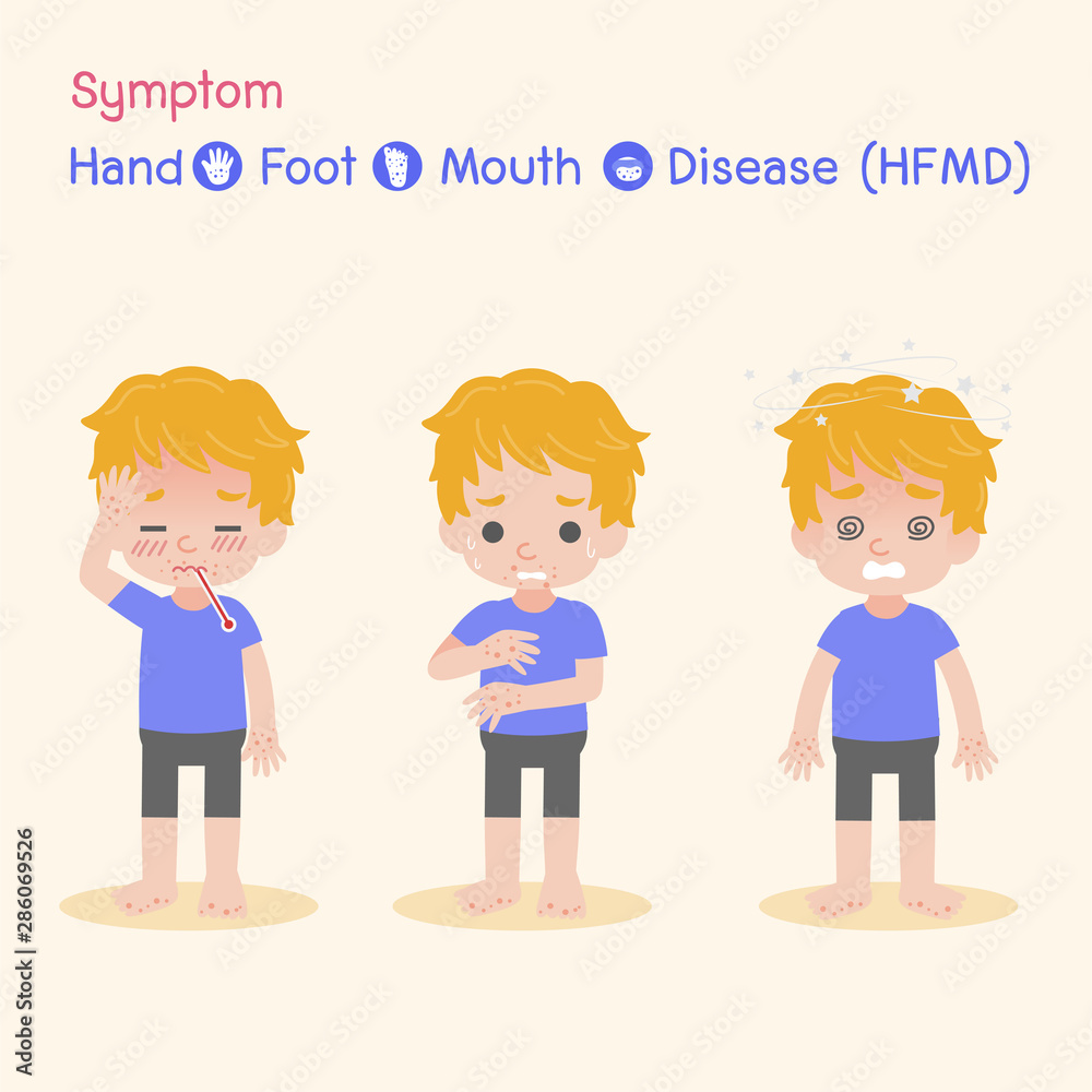 Symptom the Disease virus baby Children infected have a Blister Hand Foot Mouth Disease, HFMD in rain season, Medical Health care concept, sick, Blister, dizzy , Headache , vector character cartoon. Symptom the Disease virus baby Children infected have a Blister Hand Foot Mouth Disease, HFMD in rain season, Medical Health care concept, sick, Blister, dizzy , Headache , vector character cartoon.
