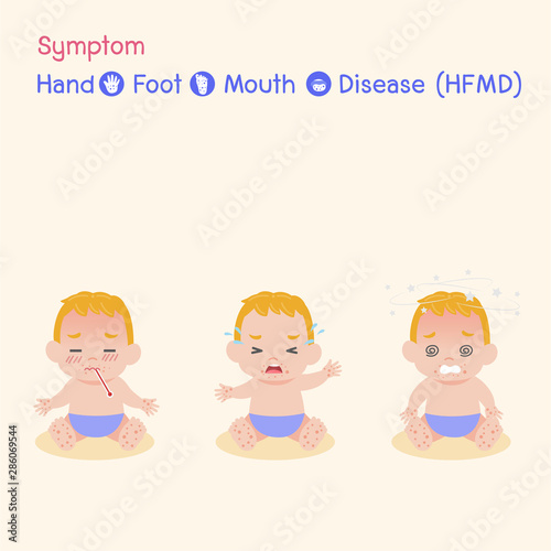 Symptom the Disease virus baby Children infected have a Blister Hand Foot Mouth Disease, HFMD in rain season, Medical Health care concept, sick, Blister, dizzy , Headache , vector character cartoon.
