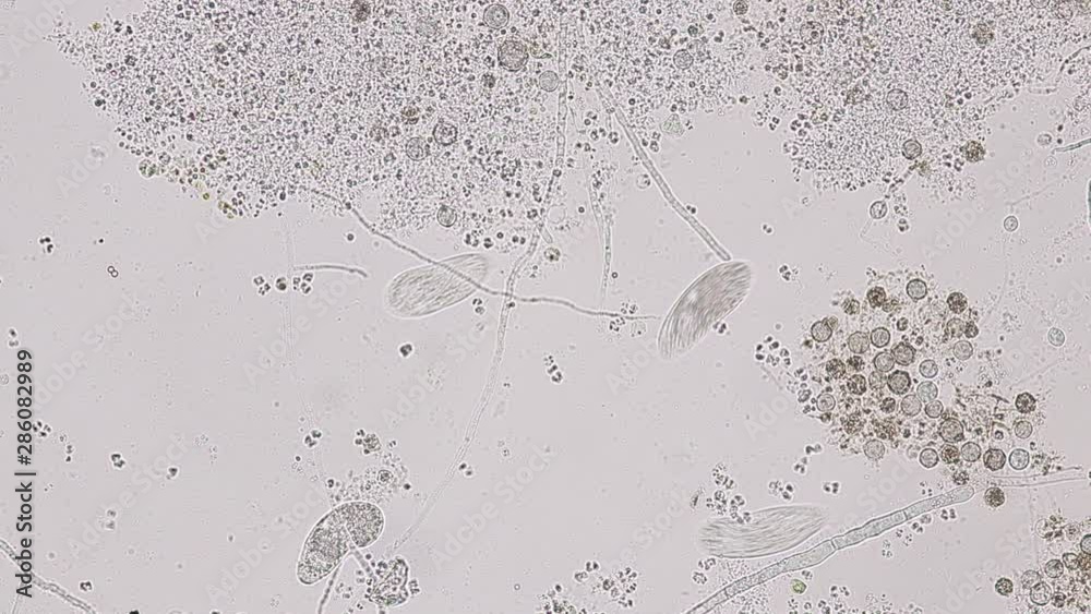 Paramecium caudatum is a genus of unicellular ciliated protozoan and Bacterium under the microscope.