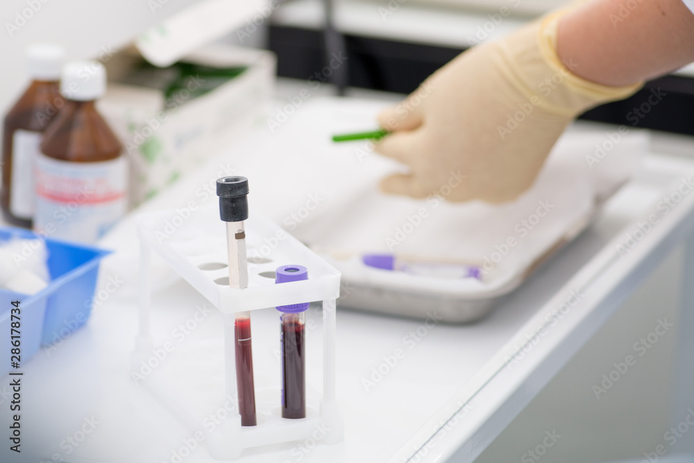 gloved laboratory assistant preparing for blood sampling against a background of blood tubes
