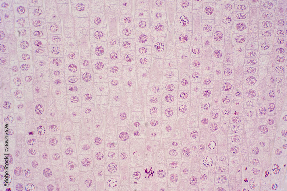 Root tip of Onion show Mitosis cell in the Root tip under microscope view. Root tip of Onion show Mitosis cell in the Root tip under microscope view.