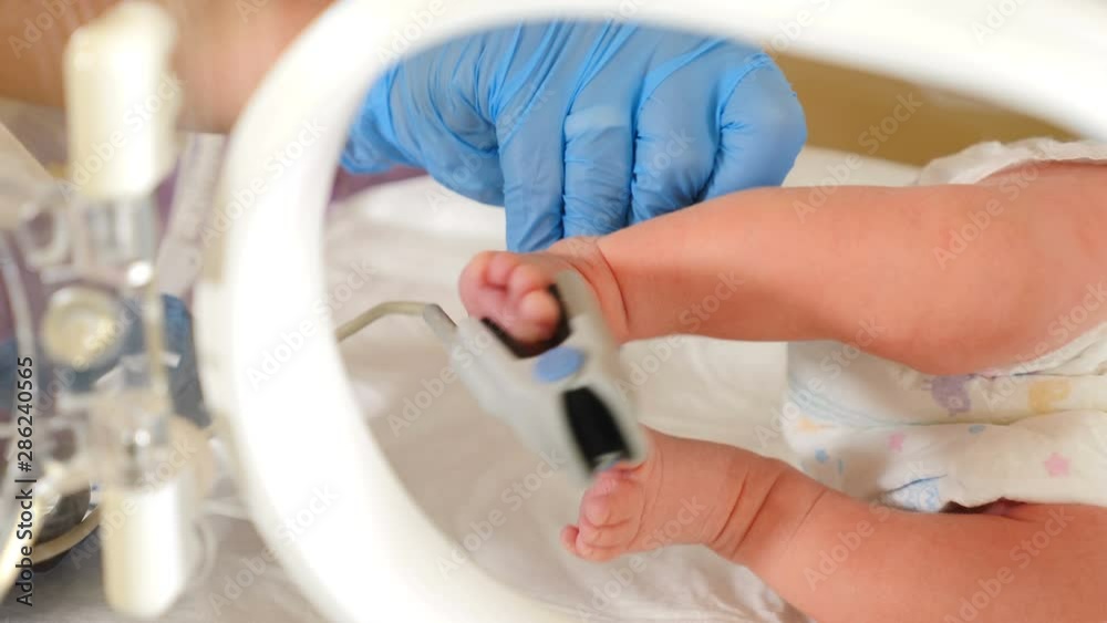 Intensive care unit for newborn children. ICU incubator sensors and tubes connected to infant legs and feet. New life saving concept. 4 k video Intensive care unit for newborn children. ICU incubator sensors and tubes connected to infant legs and feet. New life saving concept. 4 k video
