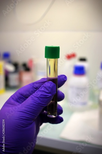 close-up of a urine test specimen for drug detection and doping