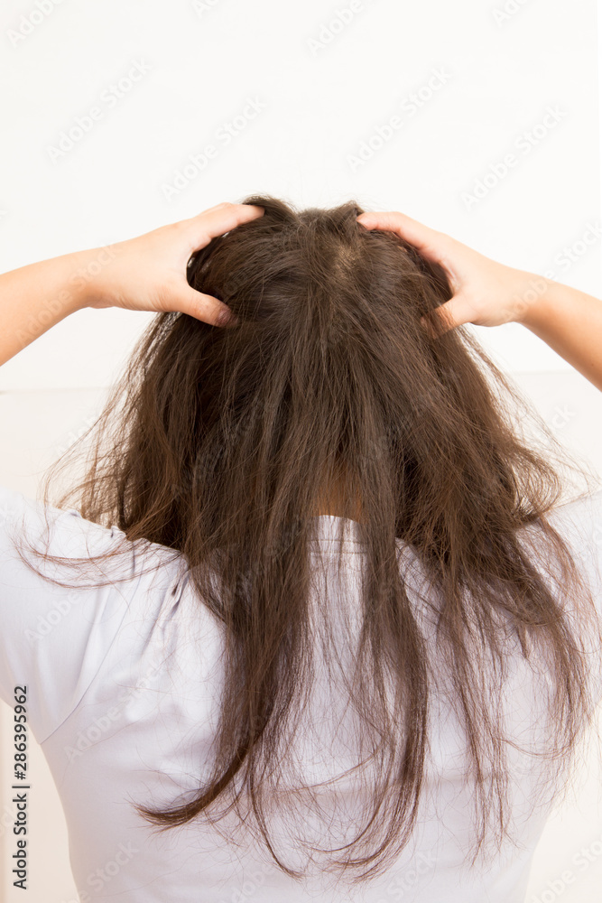 Woman suffering from an headache itching her head Woman suffering from an headache itching her head