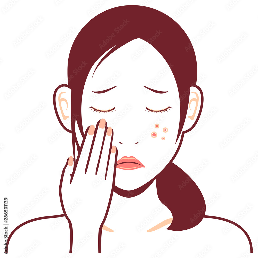 Young asian woman face vector illustration / acne, treckles Young asian woman face vector illustration / acne, treckles
