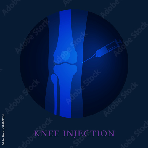 Knee joint injection treatment.  Person suffering from pain and arthritis disease. Human body anatomy 3D icon. Orthopedic medical concept. Isolated vector illustration.